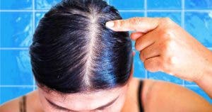Comment se débarrasser des cheveux gras sans les laver