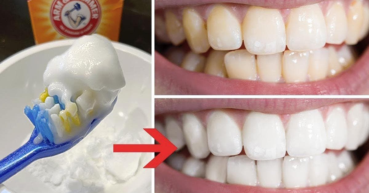 Bicarbonate de soude pour les dents : comment bien l'utiliser ?