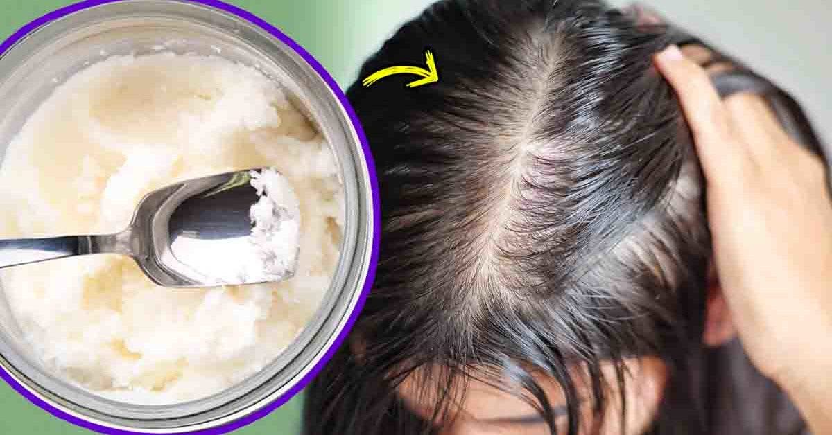 Comment utiliser l'huile de noix de coco pour arrêter la chute de cheveux  et accélérer leur croissance ?