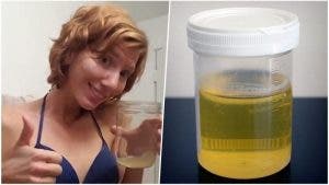 De plus en plus de femmes appliquent de l’urine sur le visage pour avoir une jolie peau