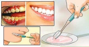 Débarrassez-vous de la plaque dentaire en seulement 5 minutes ! Cela va changer votre vie !