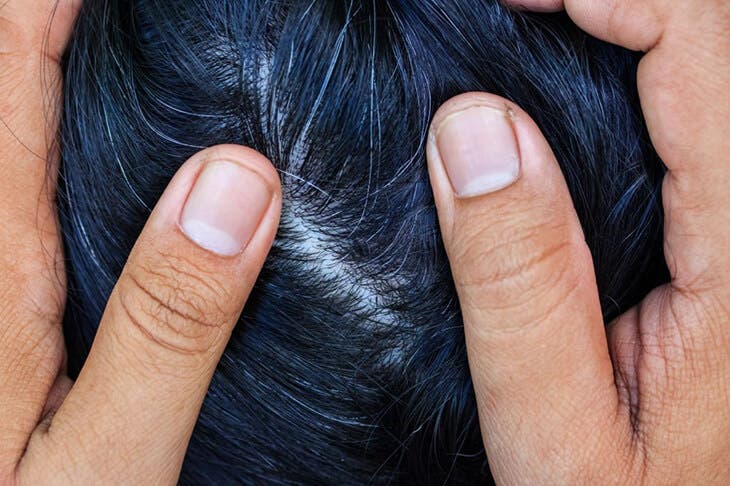 Des cheveux gris Des cheveux gris