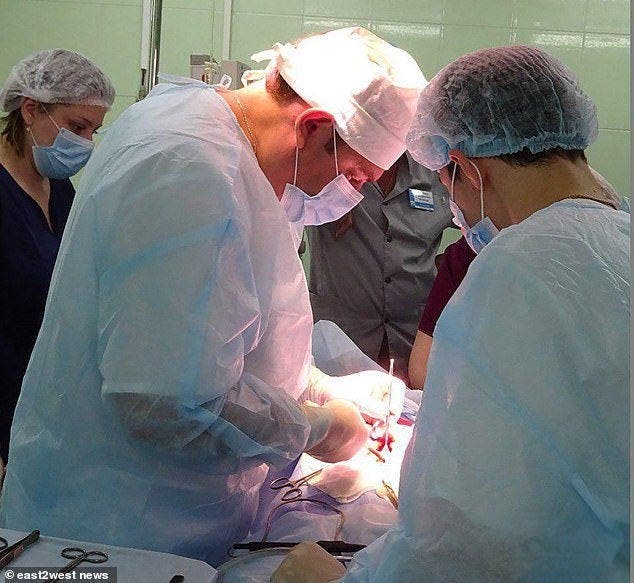 Des médecins enlèvent un demi kilo et de poils de l'estomac d’une fille