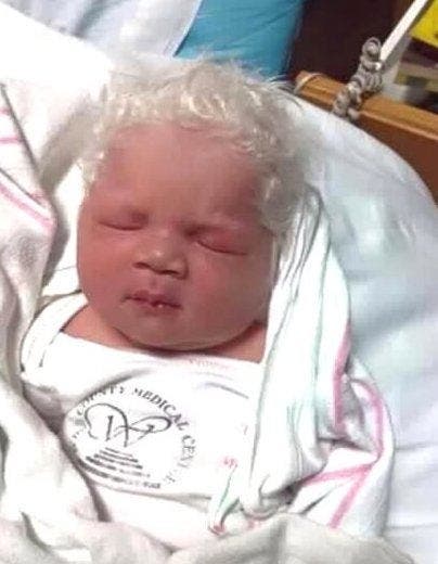 Des parents inquiets demandent aux médecins pourquoi leur bébé est né avec des cheveux gris