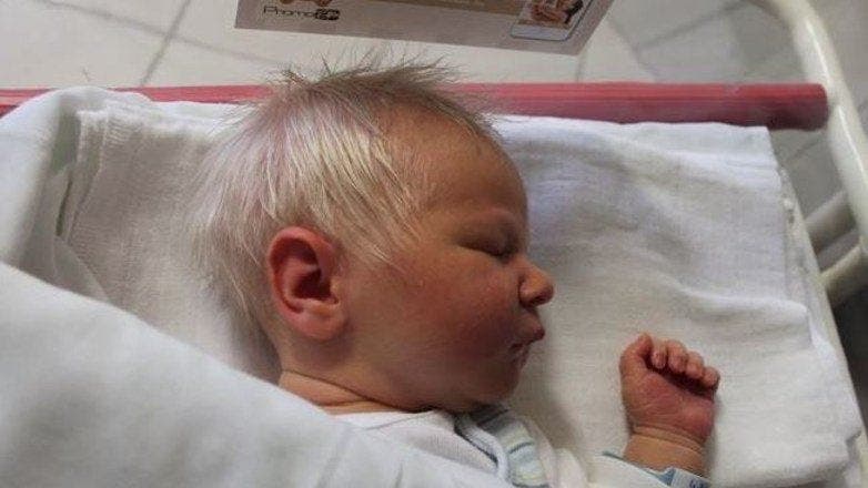 Des parents inquiets demandent aux médecins pourquoi leur bébé est né avec des cheveux gris