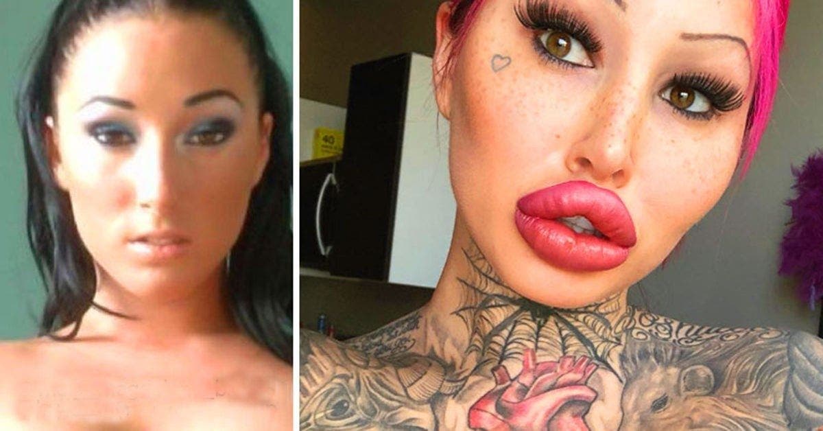 Elle dépense 88 000 euros en chirurgie et révèle les photos de sa transformation
