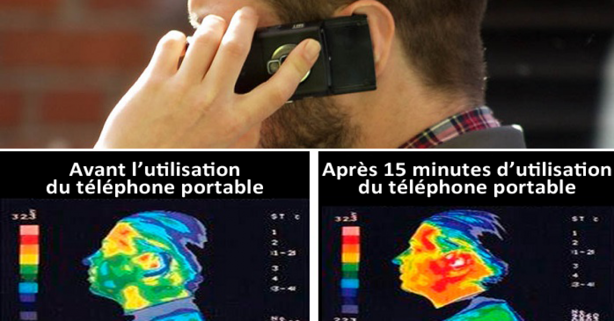 Etude ce que 15 minutes au telephone portable font a votre cerveau