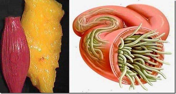Get rid of all the fat and parasites in your body with this powerful tip
