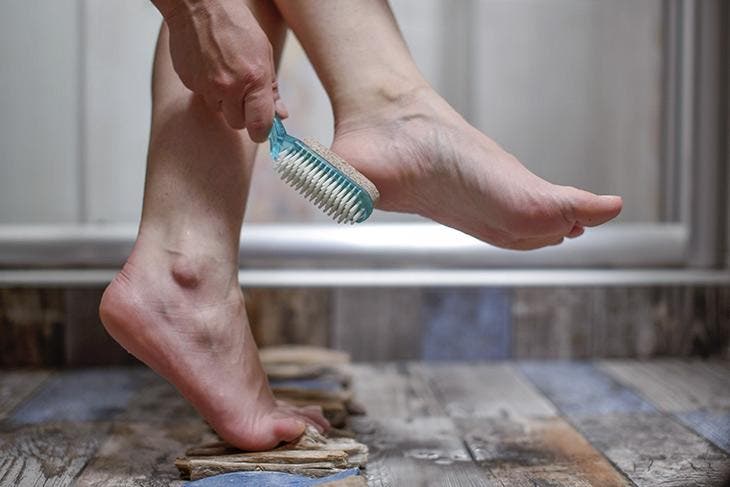 Exfoliate dead skin on the feet with a pumice stone
