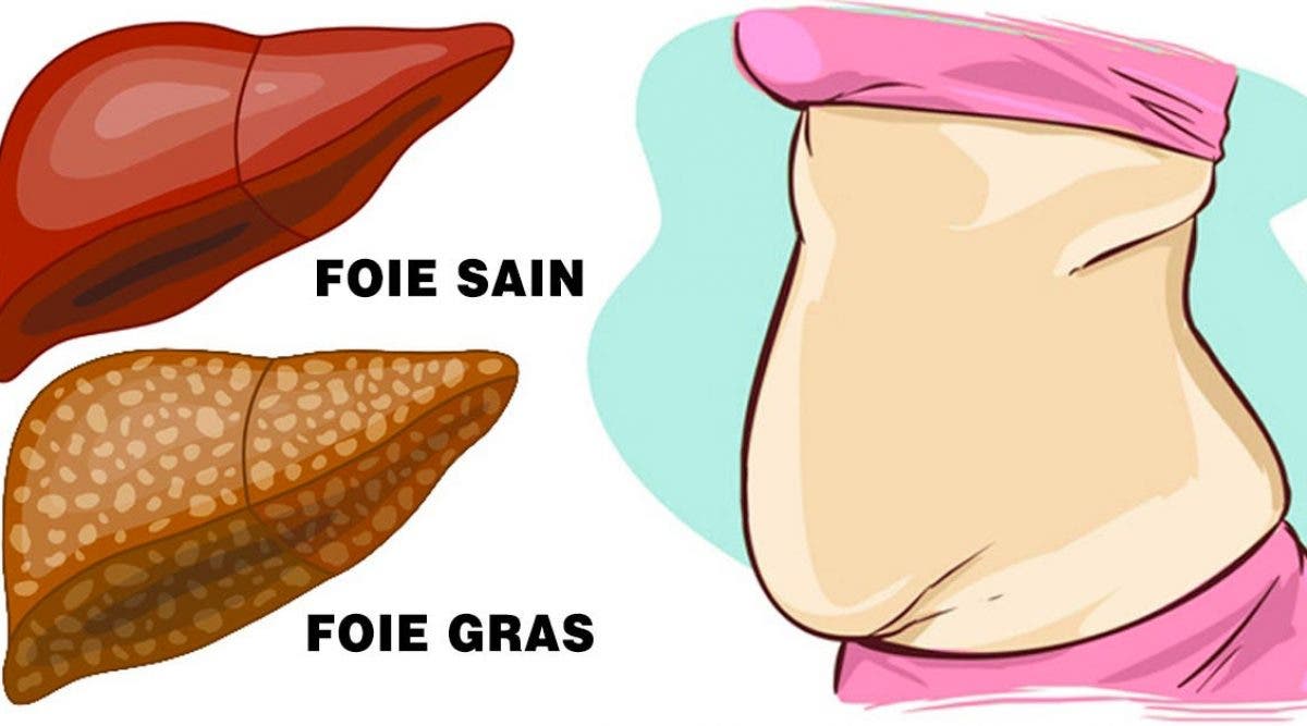 toxine foie