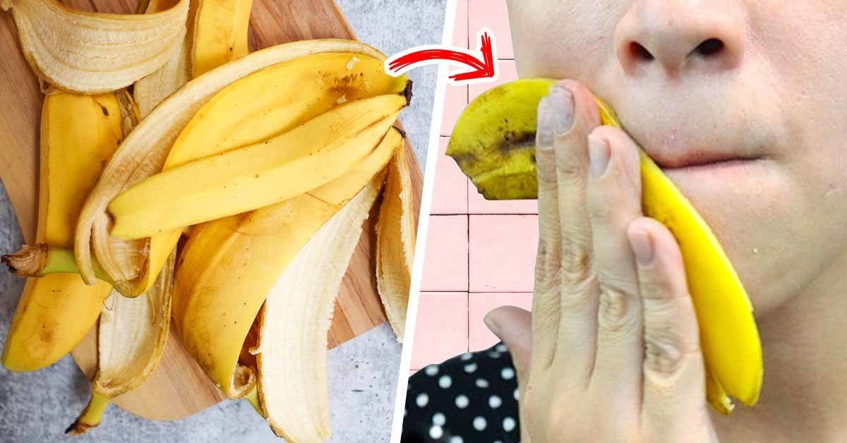 Bienfaits de la banane  Bienfait de la banane sur la peau et les