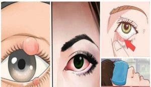 Identifiez ces signes sur vos yeux avant quils ne deviennent graves 1