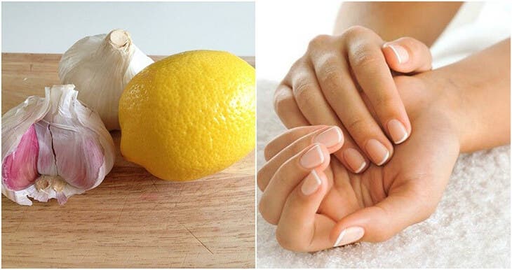 L'Ail et le citron pour renforcer les ongles abîmés