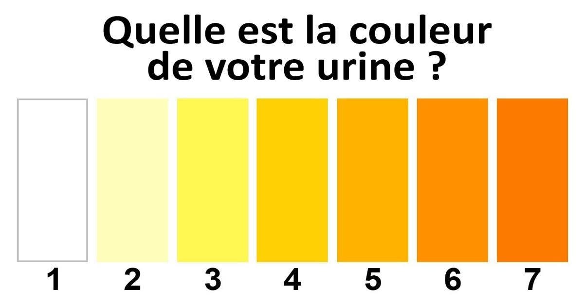 Quelle est la couleur de votre urine ?