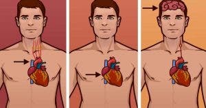 La différence surprenante entre crise cardiaque et arrêt cardiaque qui vous aidera à sauver une vie