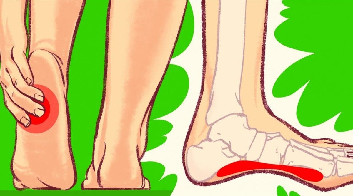 astuces pour soulager les douleurs au talon