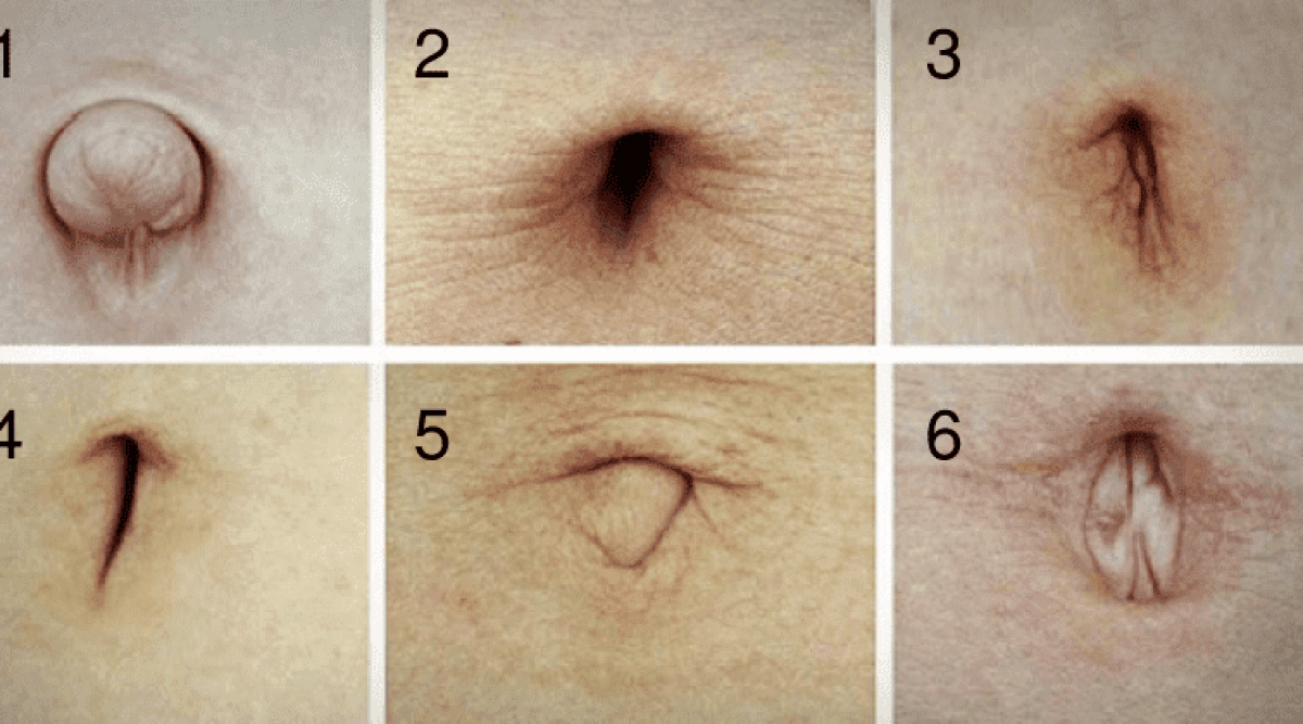 forme de votre nombril