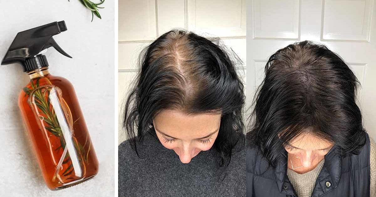 L'astuce naturelle et magique pour stopper la chute de cheveux