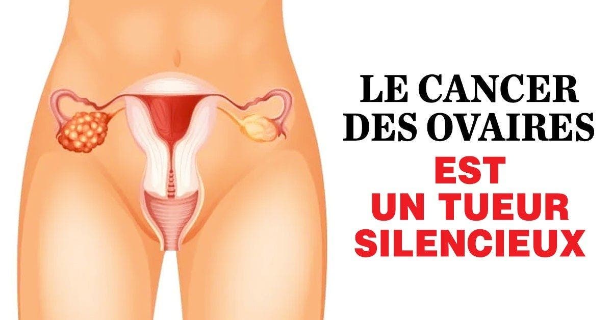 Le cancer des ovaires est un tueur silencieux