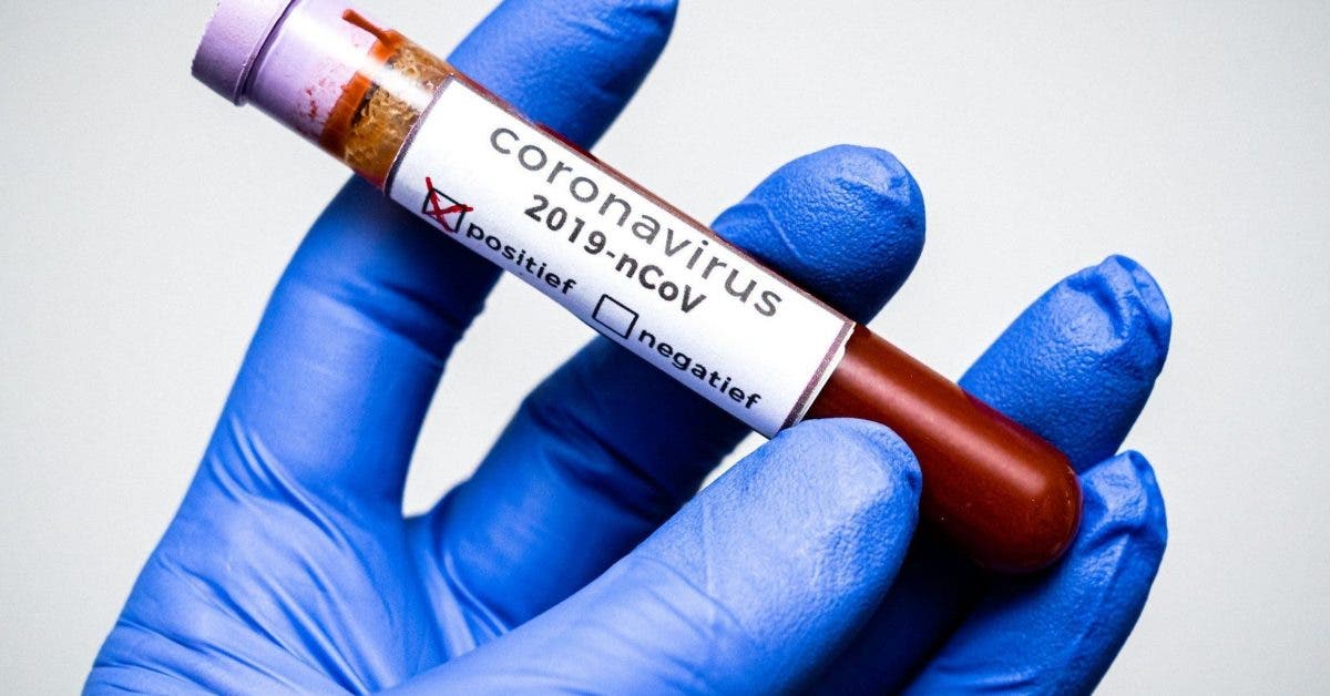 Le coronavirus aurait des gènes « semblables à ceux du VIH » qui lui permet d’attaquer les cellules humaines d’après des scientifiques