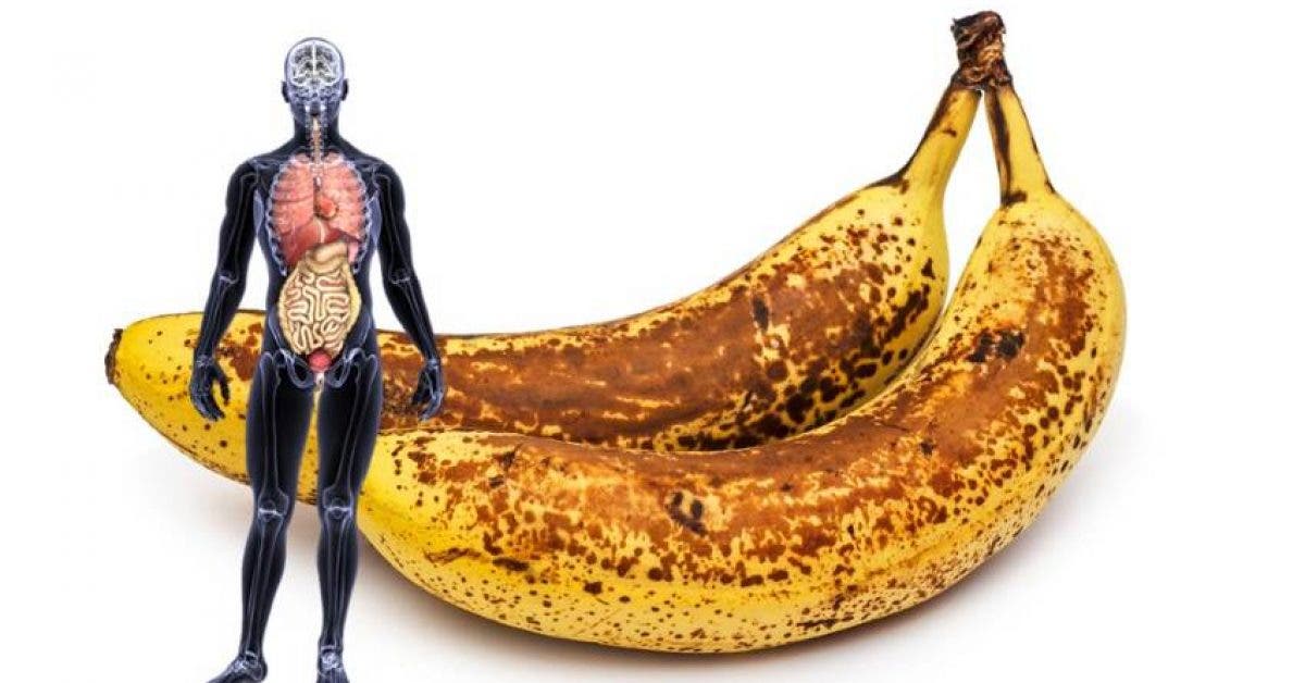 Les bananes sont des médicaments naturels