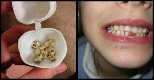 Les médecins demandent aux parents à garder les dents de lait de leur enfant