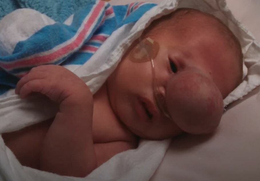 Les médecins ôtent ceci du visage de ce bébé