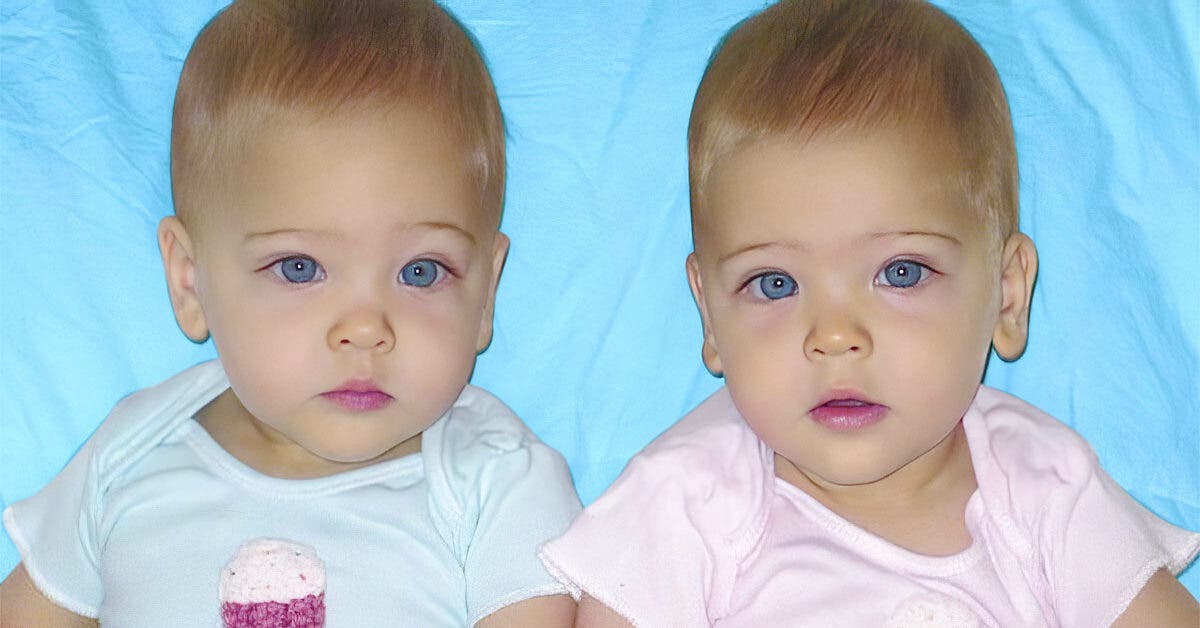 Les plus belles jumelles du monde ont désormais 12 ans001