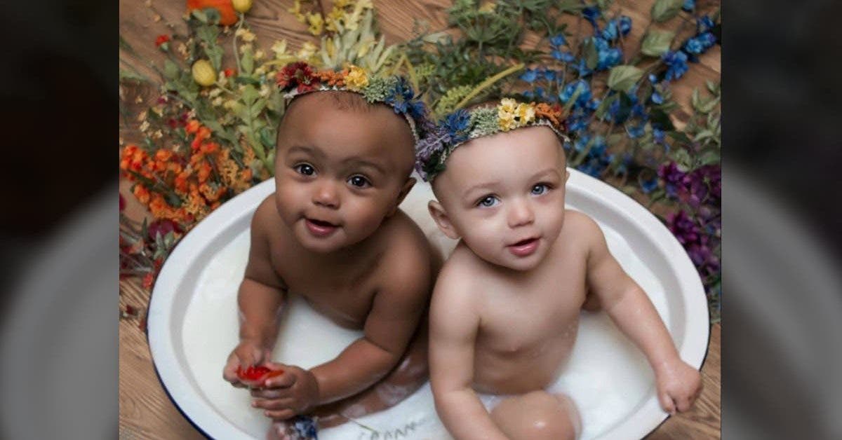 Les premières jumelles nées avec une couleur de peau différente ont aujourd’hui 21 ans