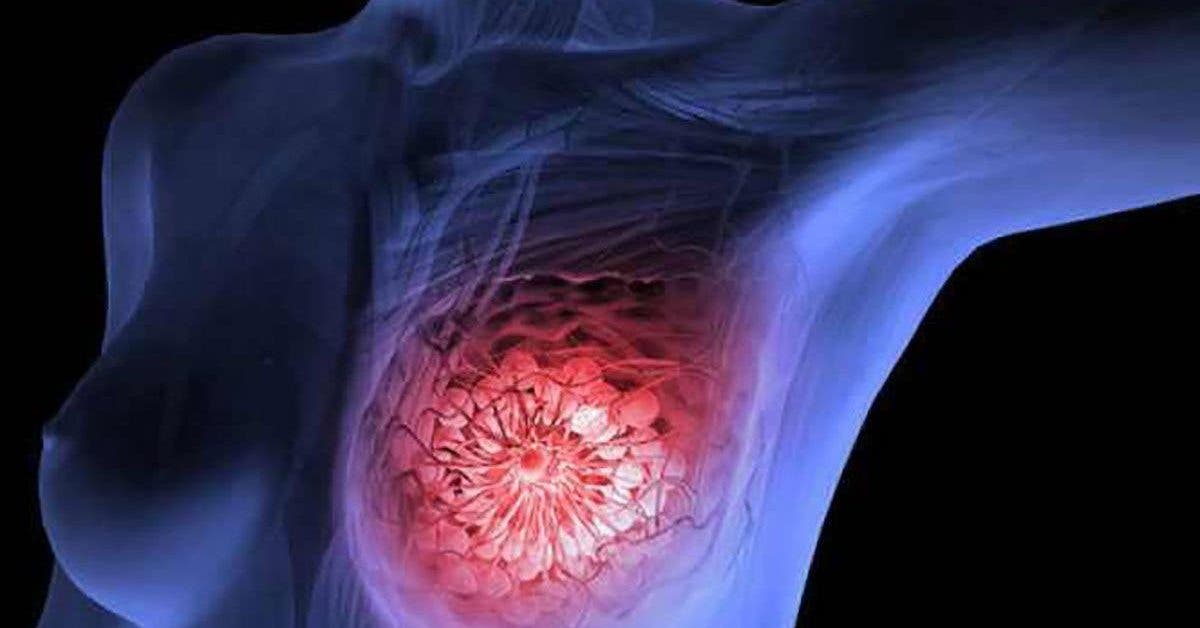 Les scientifiques ont découvert que cette boisson populaire provoque le cancer du sein