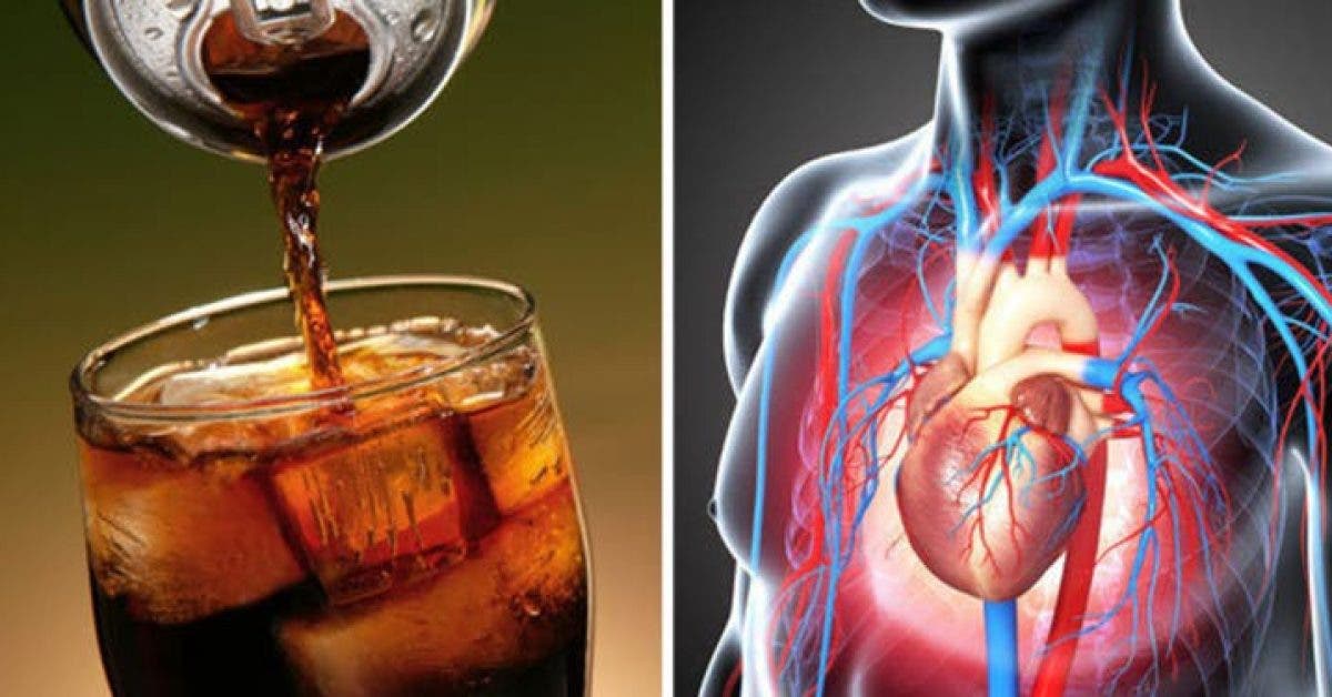 Les sodas sans sucres sont lies au gain de poids a la demence et aux accidents vasculaires cerebraux dapres les experts 1