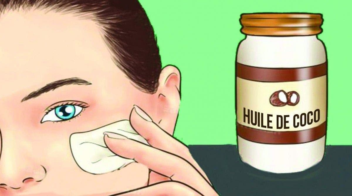 huile de noix de coco