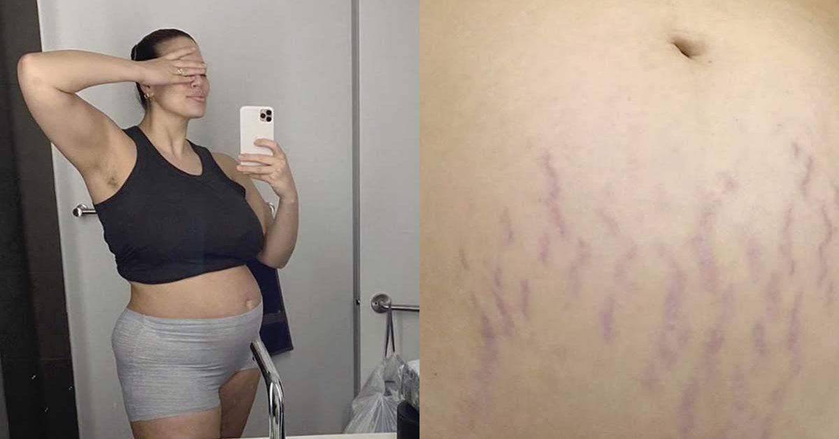 « N’ayez pas honte de votre corps » La top model Ashley Graham montre ses vergetures après son accouchement