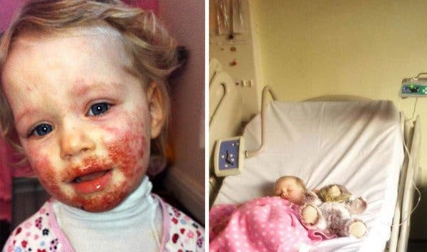 Personne ne comprend pourquoi sa fille a des inflammations sur son visage