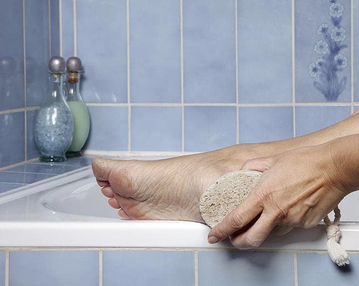 pumice stone for cracked heels