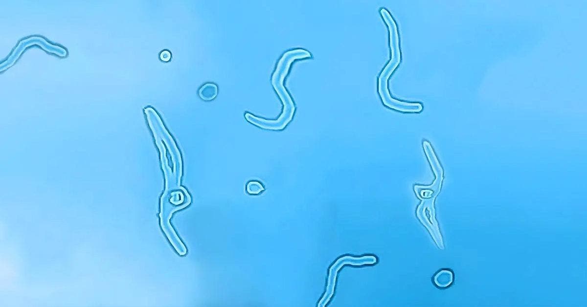 Pourquoi voit-on des choses étranges flotter devant nos yeux ?