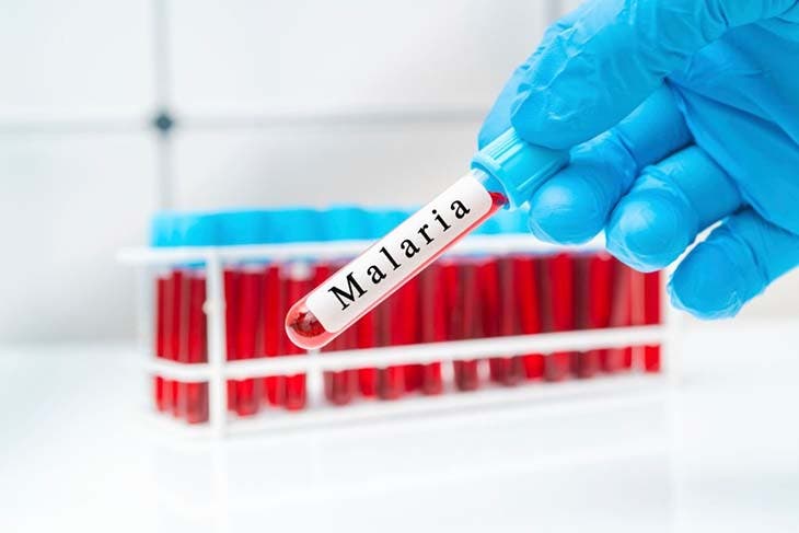Malaria test