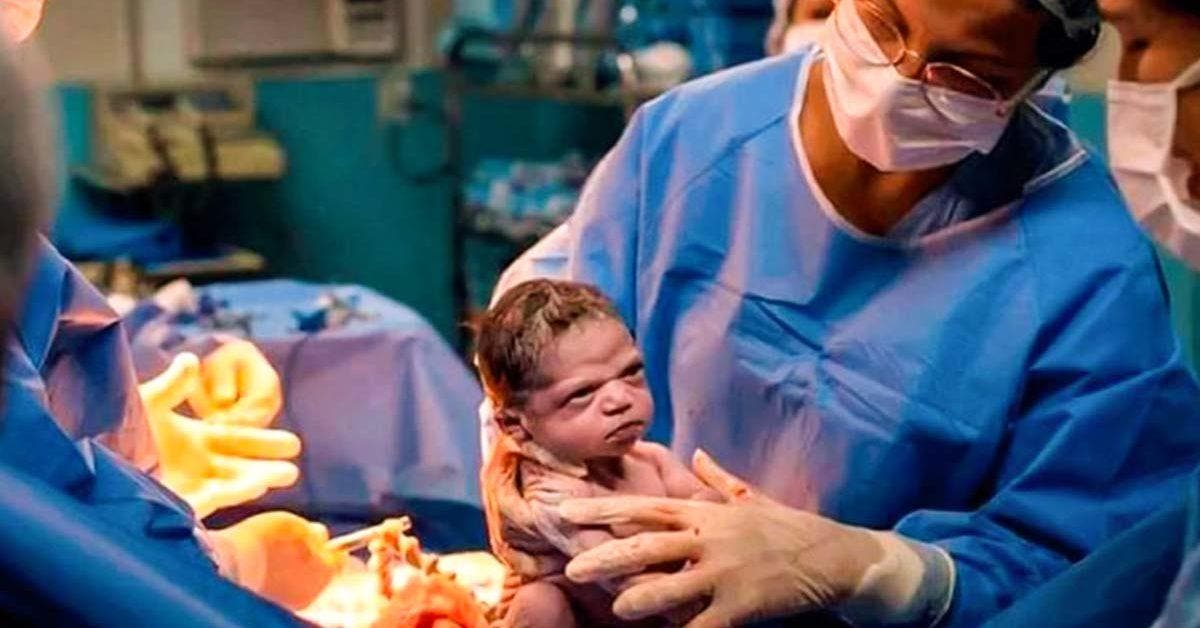 Quelques secondes après sa naissance ce bébé adresse un regard noir au médecin
