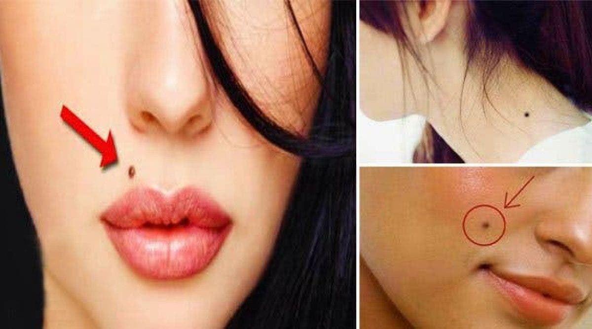 Si vous avez des grains de beauté sur ces 12 parties de votre corps