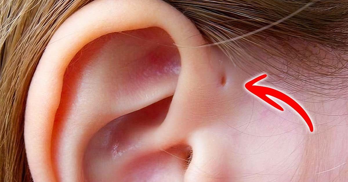 Si vous avez un petit trou au-dessus de votre oreille, voici ce ...