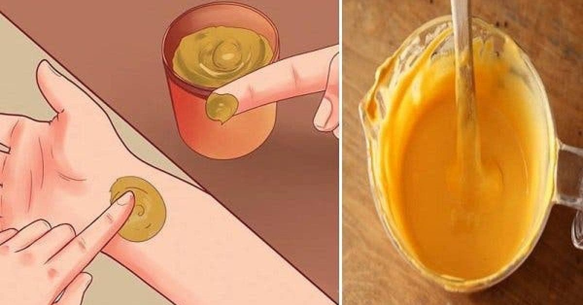 This is What They Forgot To Tell You About Using Turmeric For pain cuts teeth skin and more 2 1