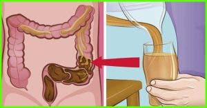 Top 10 Home Remedies For Colon Cleansing 3 1