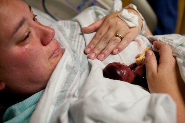 Un bébé est né lors de sa 19ème semaine