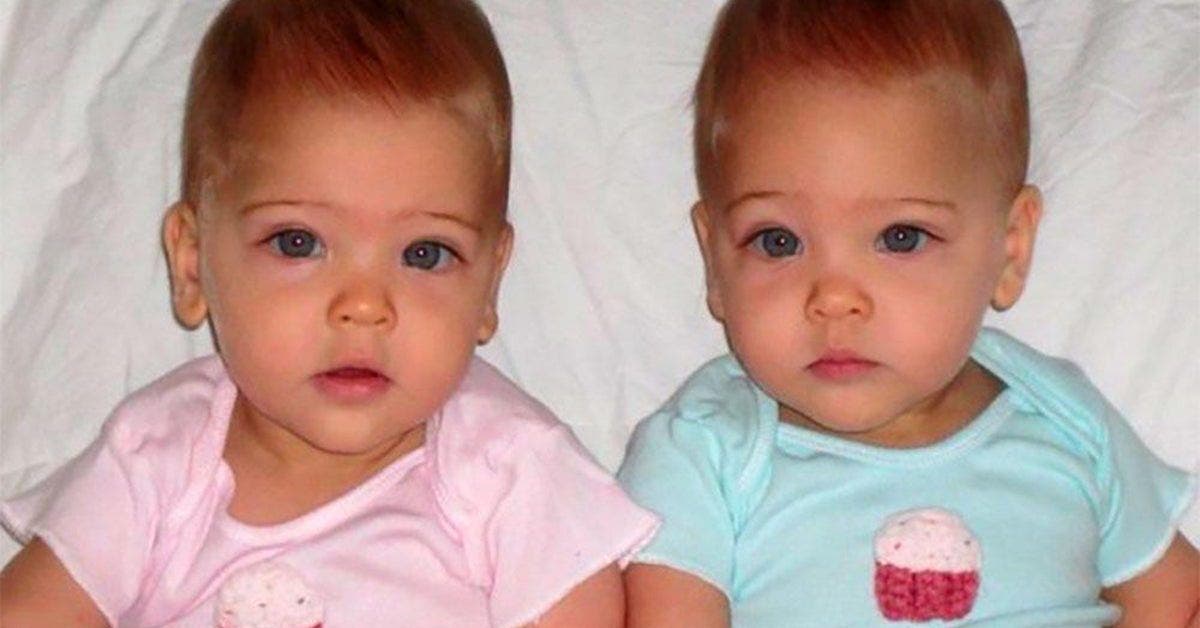Un couple à donné naissance aux « plus belles jumelles du monde » , regardez à quoi elles ressemblent aujourd’hui