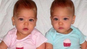 Un couple à donné naissance aux « plus belles jumelles du monde » , regardez à quoi elles ressemblent aujourd’hui