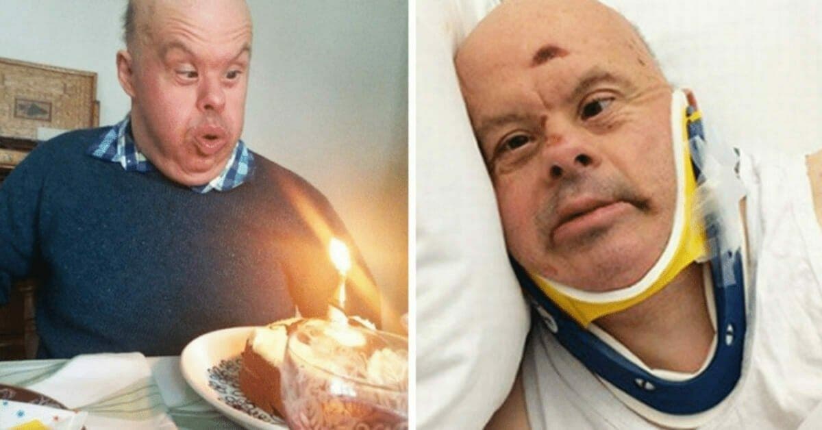 Un homme atteint de trisomie 21 décède à 61 ans après que l’hôpital l’ait laissé mourir de faim