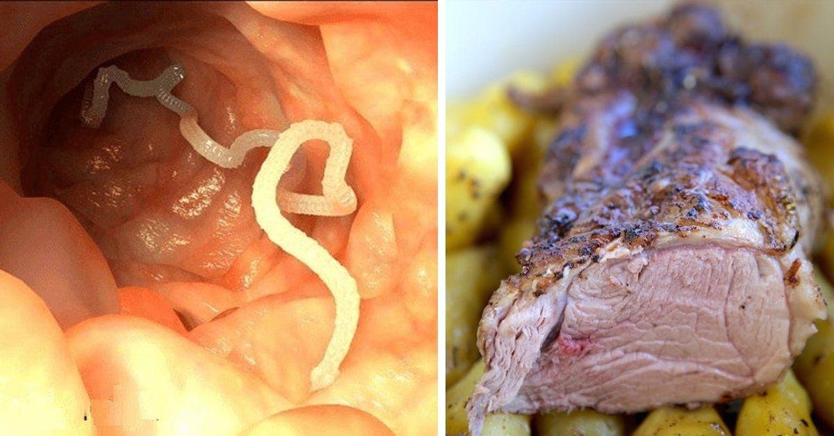 Un homme meurt d'une infestation de larves dans son cerveau après avoir mangé de la viande mal cuite