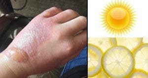 Un-medecin-previent-les-personnes-qui-touchent-du-citron-en-plein-soleil