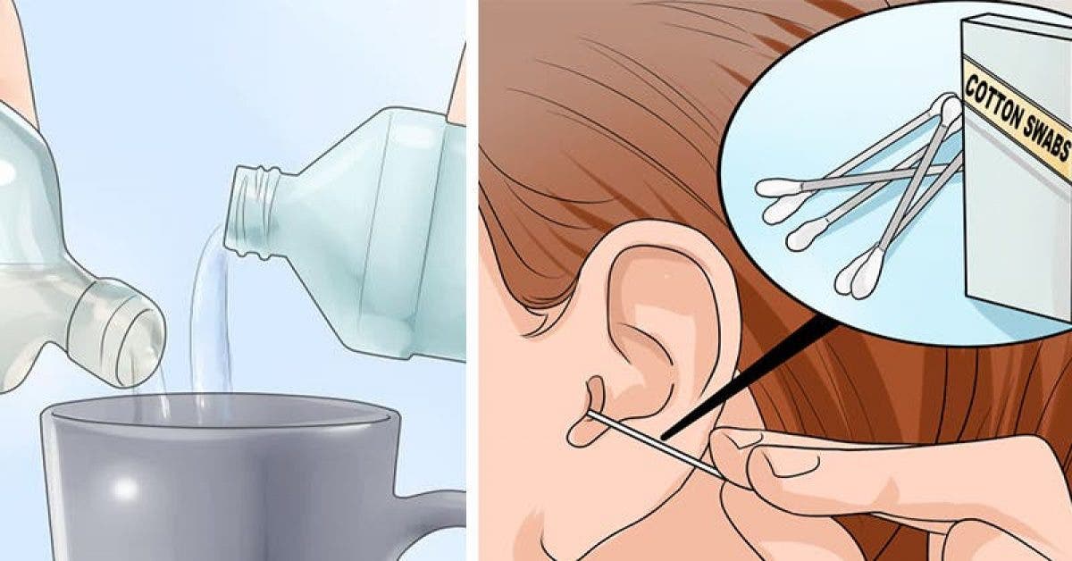 Un melange puissant pour nettoyer vos oreilles en profondeur
