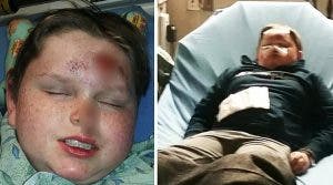 Un petit garçon est blessé par deux camarades pour avoir des likes sur TikTok